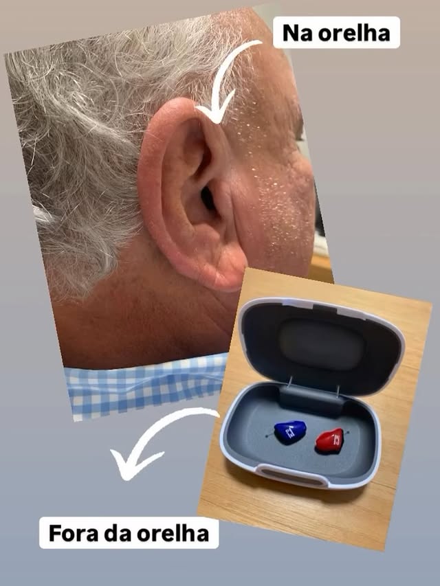 Aparelho Auditivo Microcanal na ponta do dedo